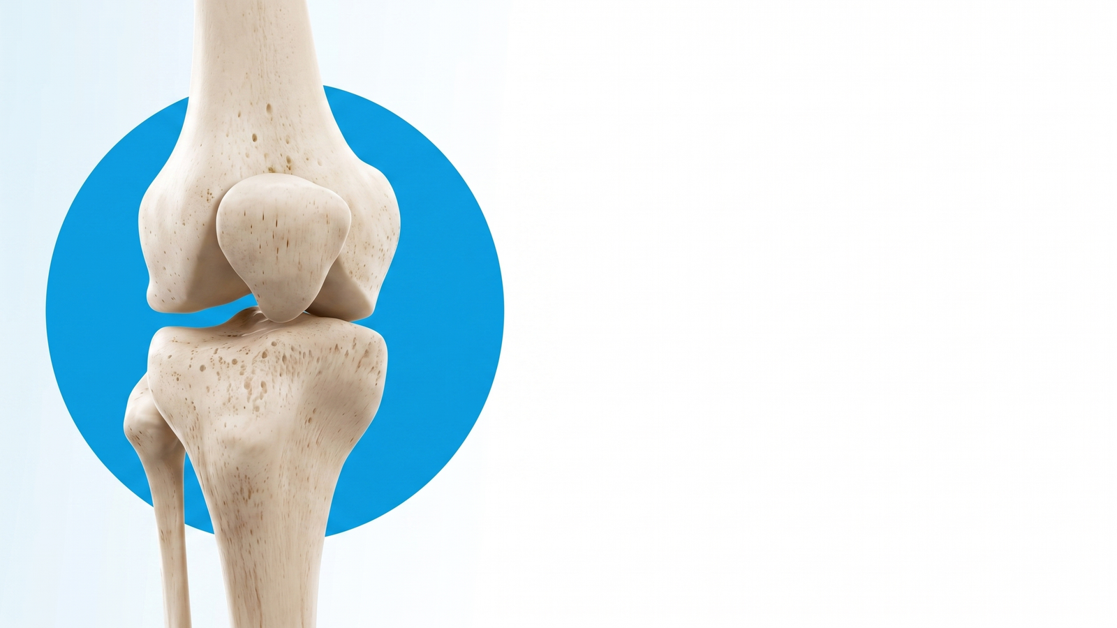 Joint Replacement Surgery